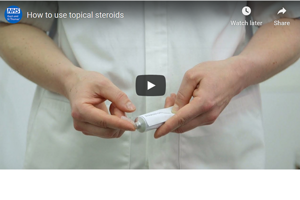 how to use topical steroids